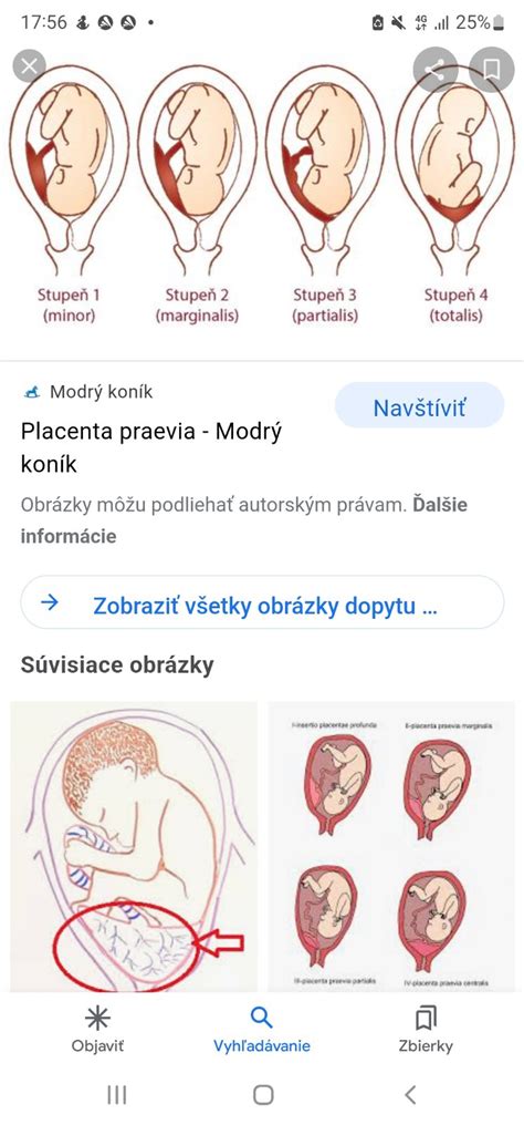 Vizualizácia pôrodných kontrakcií