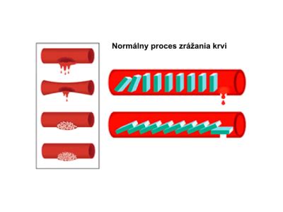 Schematické znázornenie zrážania krvi