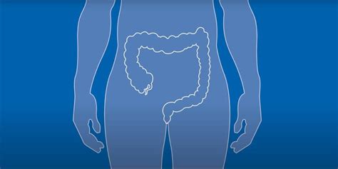 Ilustrácia procesu intrauterinnej inseminácie